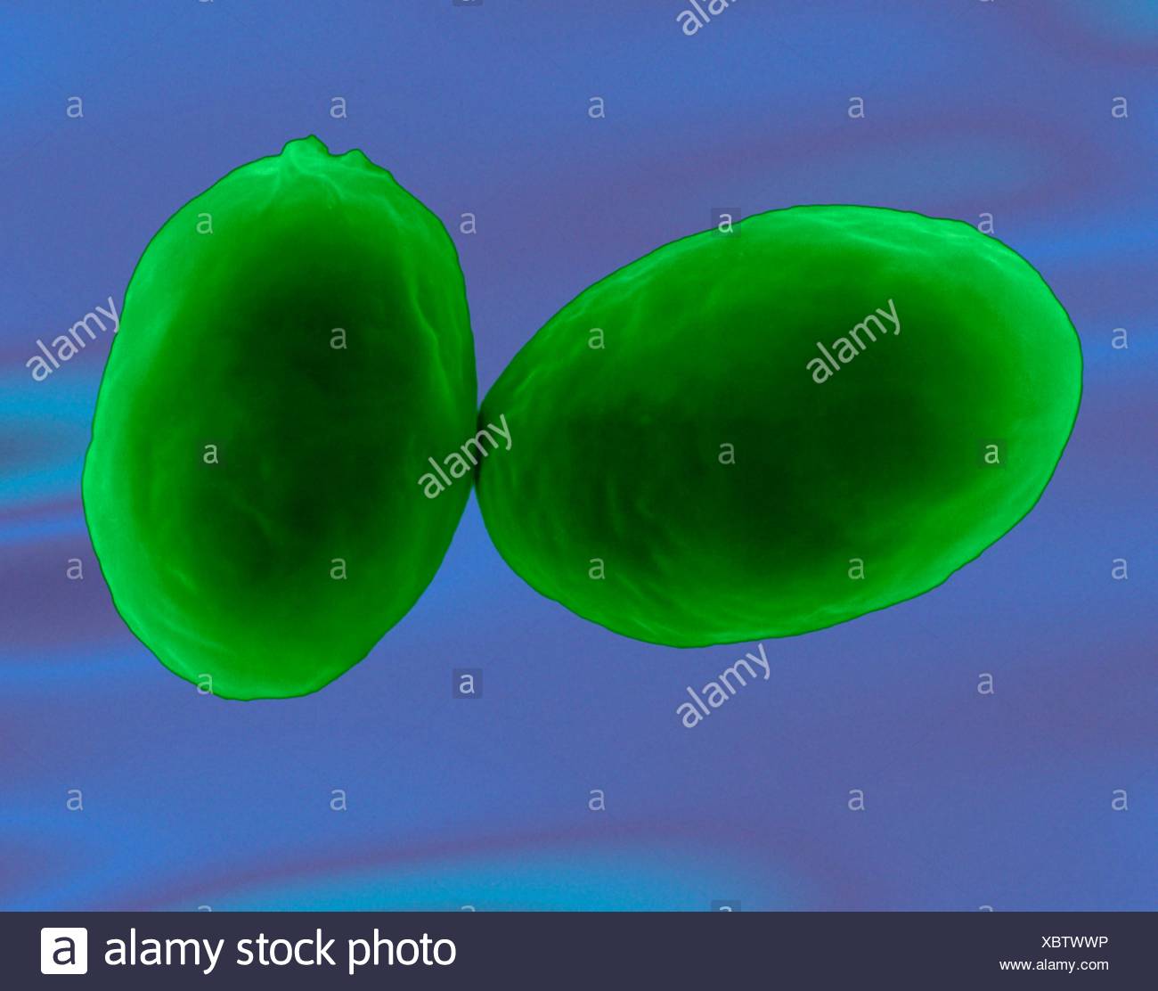 human disease caused by protozoa pdf