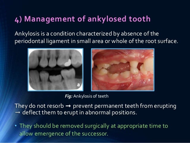 preventive and interceptive orthodontics pdf